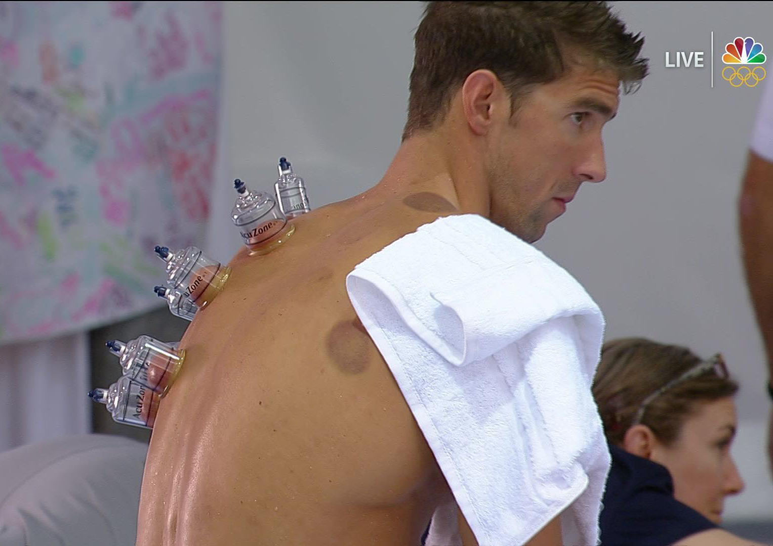 Michael Phelps cupped at 2016 Olympics